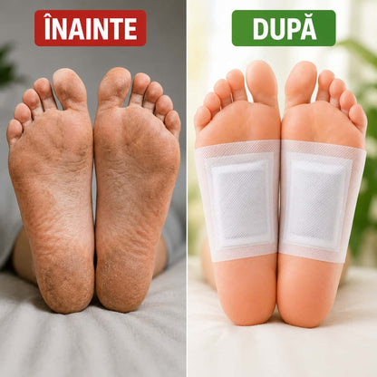 Set 100 Plasturi pentru Detoxifiere Kinoki