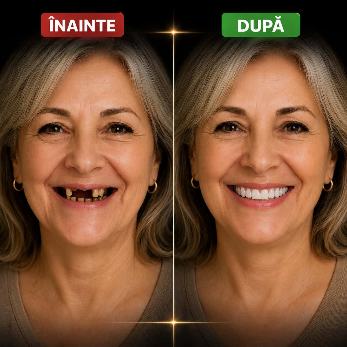 Set Proteză dentară SmileFix™ pentru un zâmbet complet