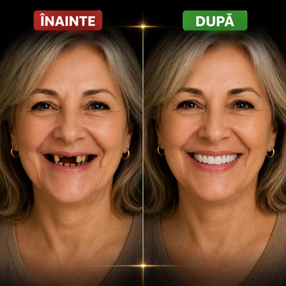 Set Proteză dentară SmileFix™ pentru un zâmbet complet